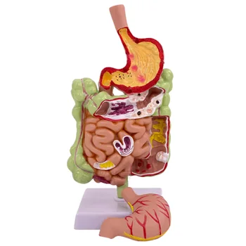 Анатомическая Модель Пищеварительной системы человека С заболеваниями Желудка, Тонкой и Толстой кишки, Строения органов толстой кишки, Анатомическая модель