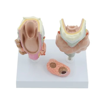 Патологоанатомическая модель щитовидной железы, модель гортани