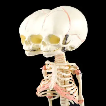 Челночный корабль Человеческий Младенец Деформирован для Исследования Головы Черепа Модель Скелета Анатомический Анат